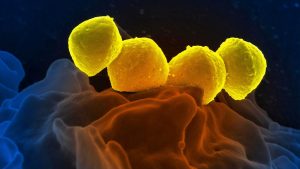 Des scientifiques de l'Empa développent un pansement qui tue les bactéries