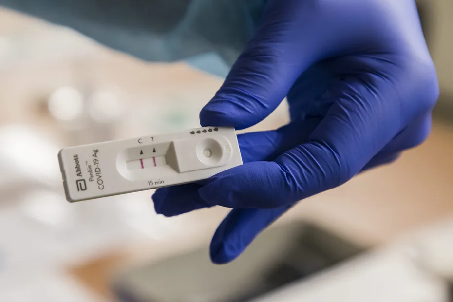 Un groupe pharmaceutique suisse lance un nouveau test pour différencier rapidement le coronavirus de la grippe